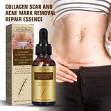 Fade Cesarean Scar Smooth Impression Repair Essential Oil