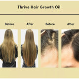 Hair Essential Oil Improve Dryness And Irritability And Nourish